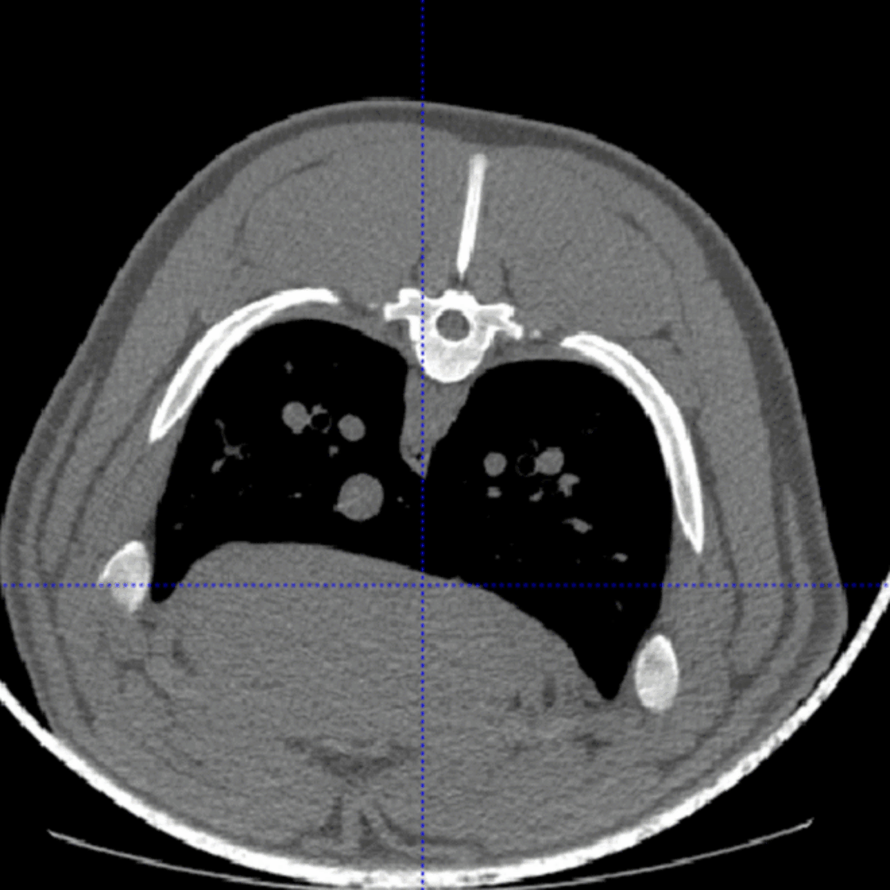 Bridging Pig Breeding and Human Health with CT Data